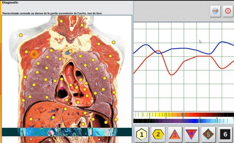 Metatron Hunter 4025