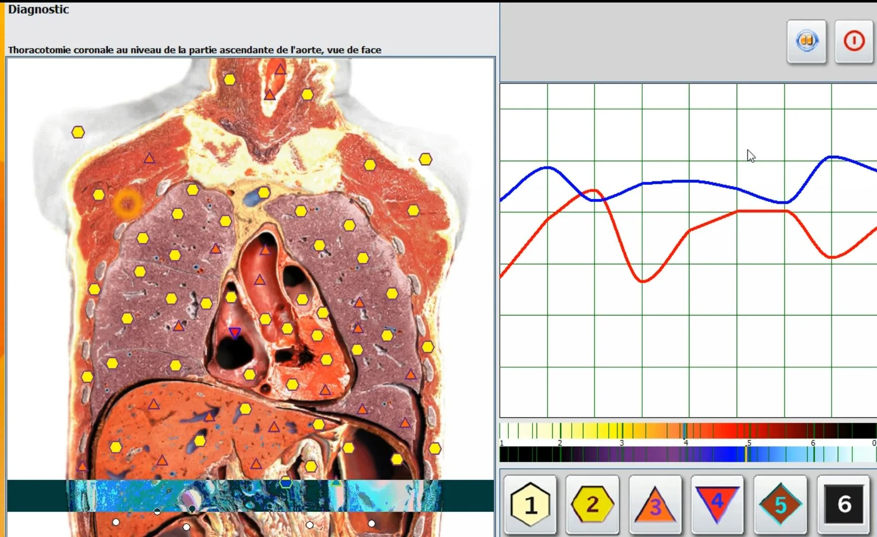 Metatron Hunter 4025
