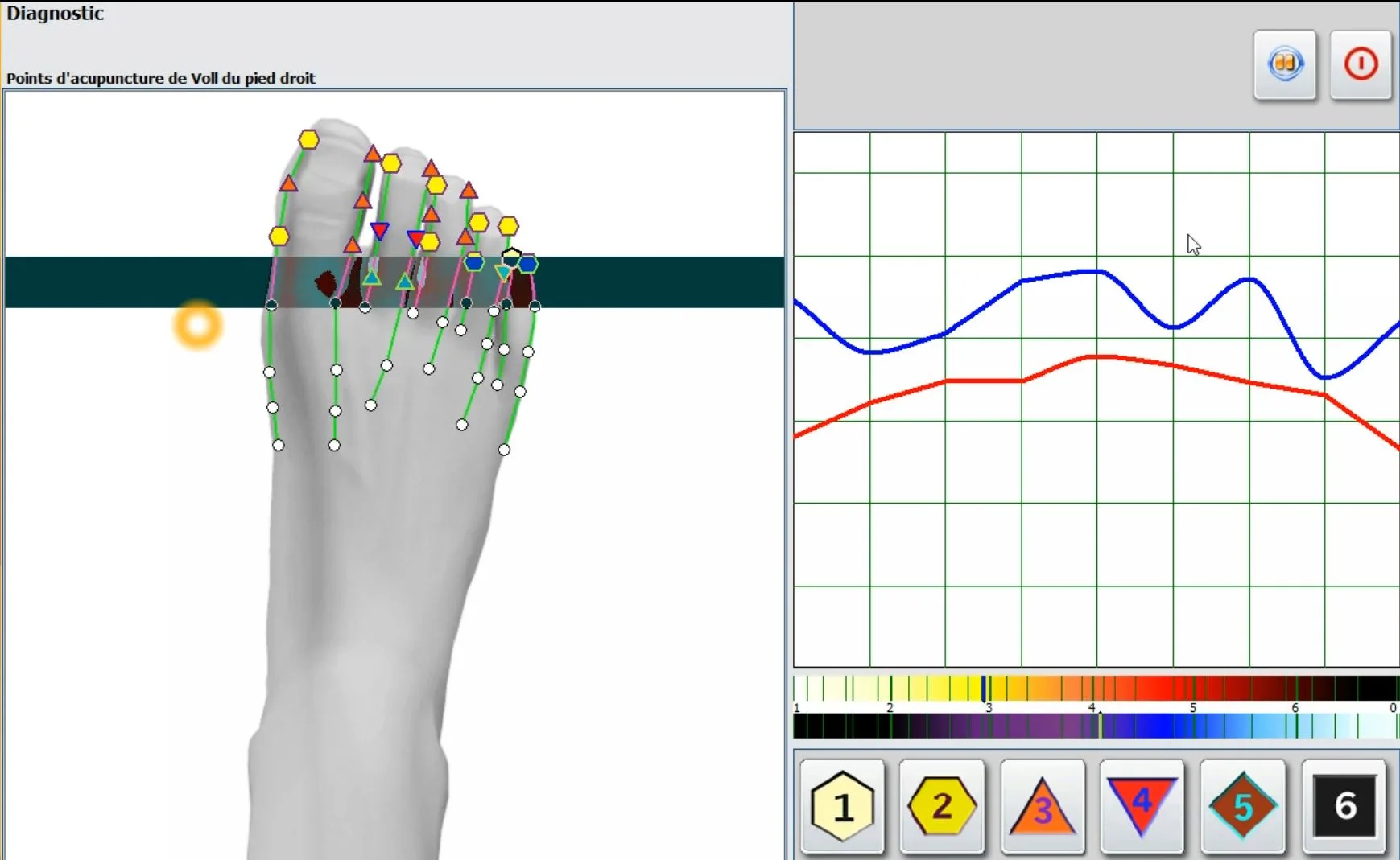 25d nls hunter 4025 metatron nls 5