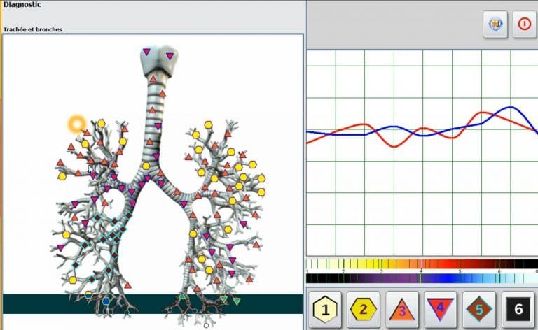Metatron Hunter 4025