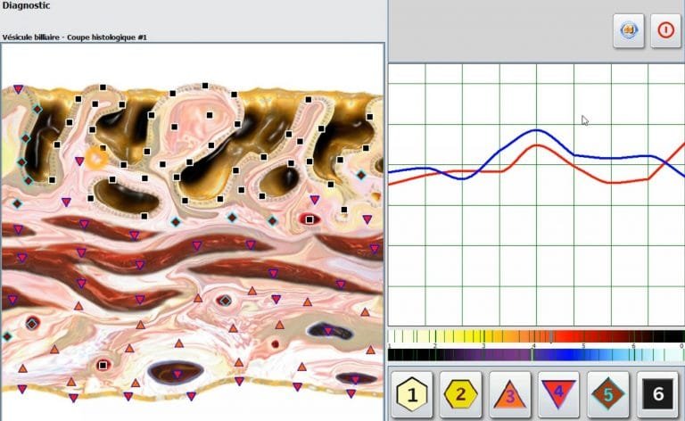 Professional 4025 sub-health analyzer