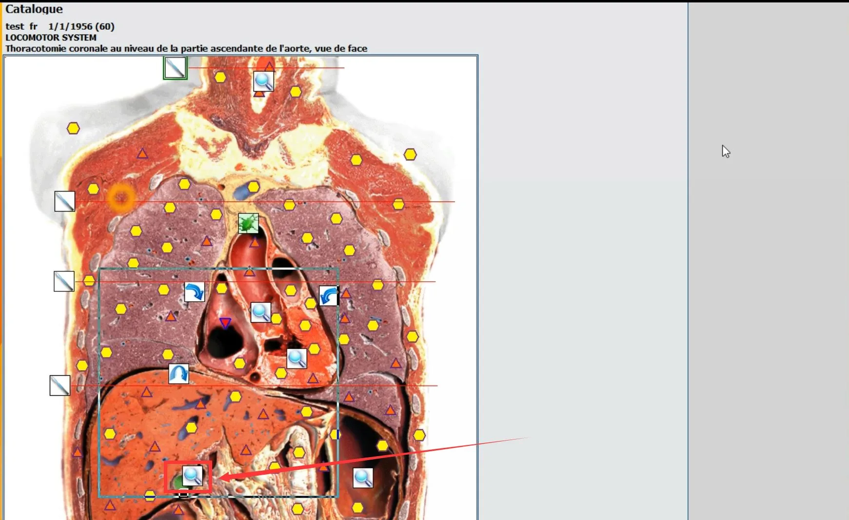 Spanish 4025 hunter body analyzer