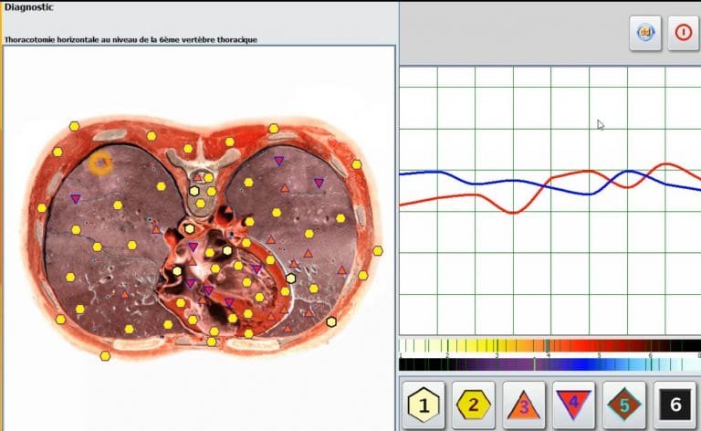 Spanish 4025 hunter body analyzer