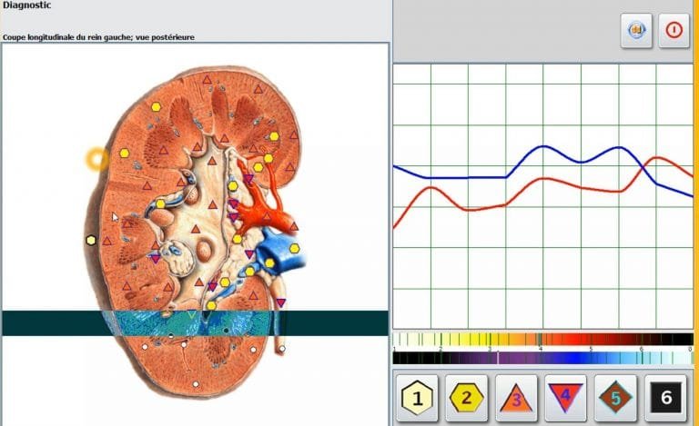 hunter 4025 metatron nls