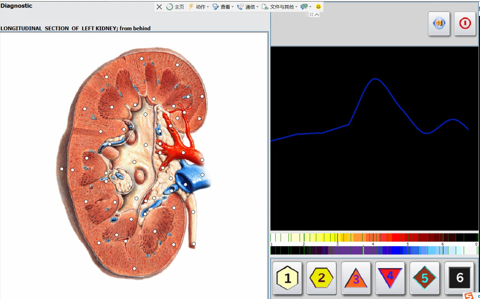 Hunter Metatron Device