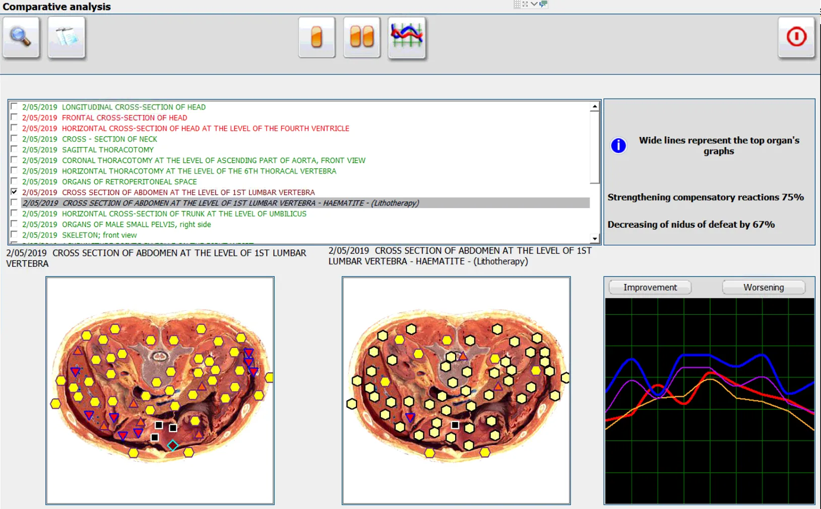 Metatron Hunter 4027