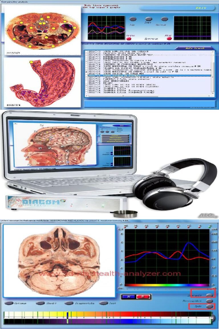 Diacom 3D NLS Software Download